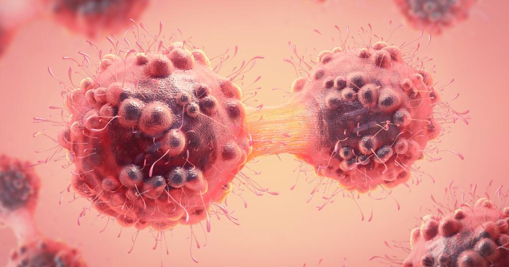 Gastric Cancer is more common in Eastern Asia