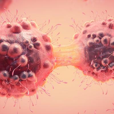 Gastric Cancer is more common in Eastern Asia